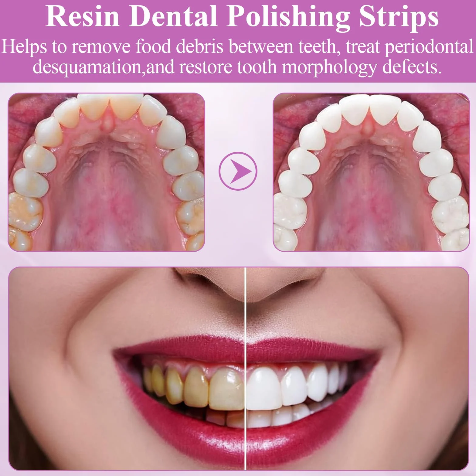 Papier ścierny dentystyczny 3 objętości paski do polerowania zębów
