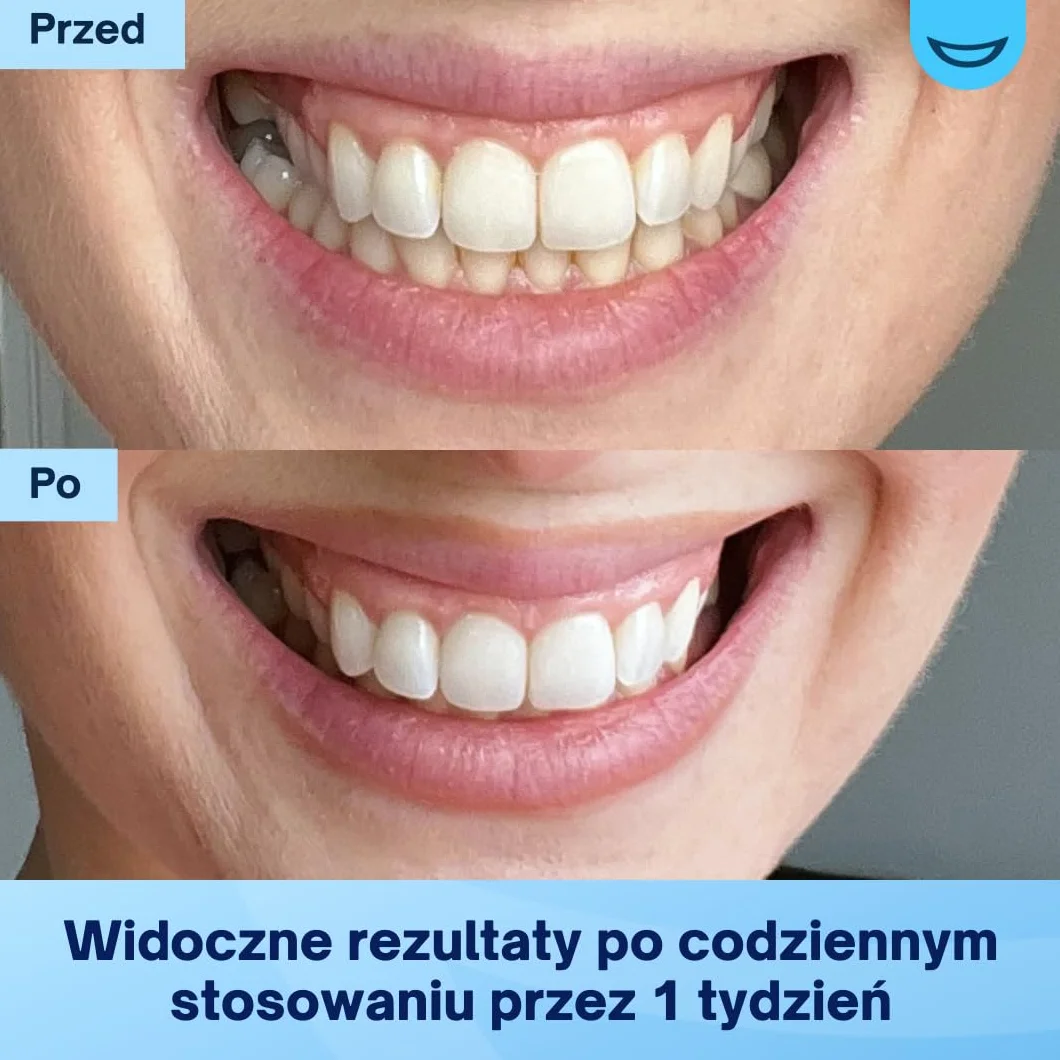MySweetSmile Paski Wybielające Zęby PAP - Bezpieczne Dla Szkliwa, Bez Nadwrażliwości - Bez Peroksydu - Zatwierdzone Przez Dentystów - Nagroda IndyBest - 21 Zabiegów - Miętowy Smak