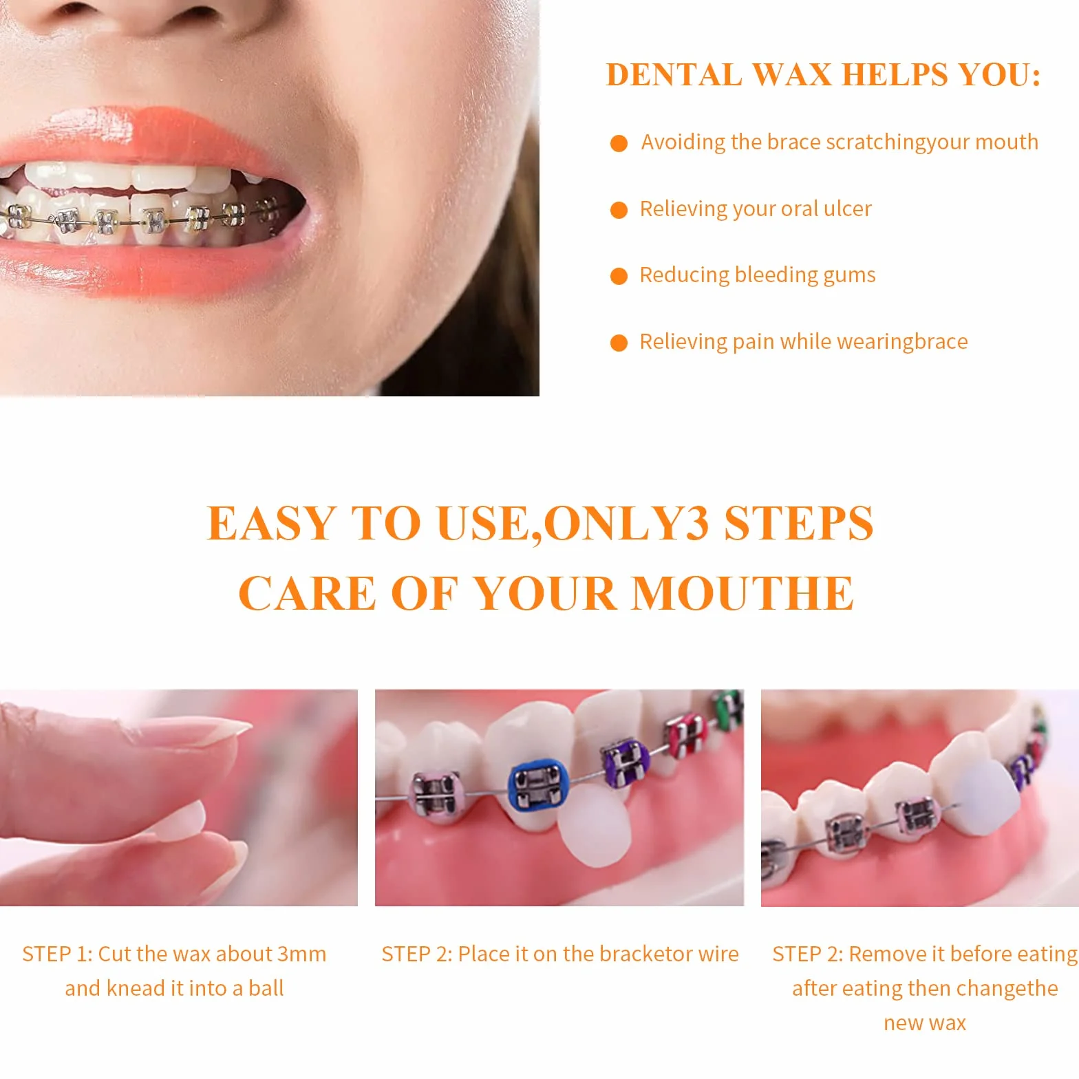 10 szt. wosku dentystycznego, pudełka na szelki, wosk dentystyczny na ramiona, urządzenie łagodzące podrażnienia i ból, aparaty ortodontyczne, wosk dentystyczny, 10 kolorów i 10 smaków